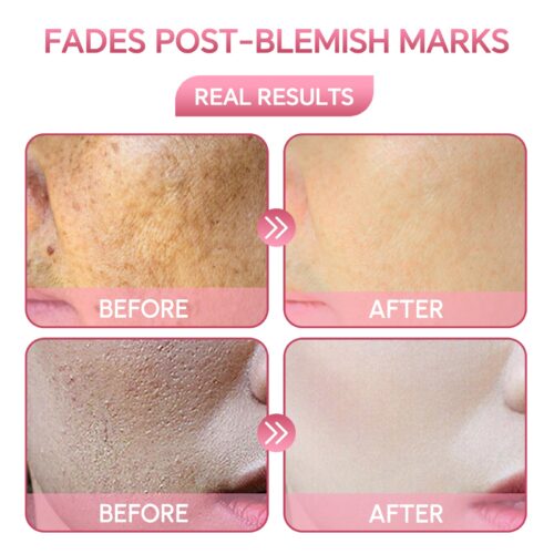 1 fl oz Face Serum for Wrinkles, Dark Spots, and Anti-Aging with - Image 4