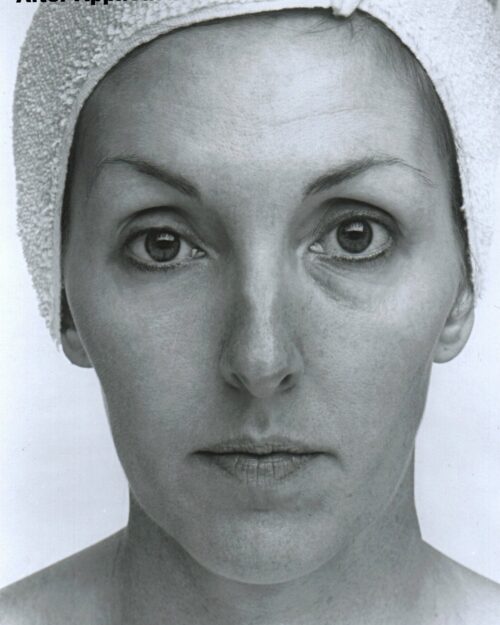 Collagen Lifting Facial with Rapid Wrinkle Erase Cream